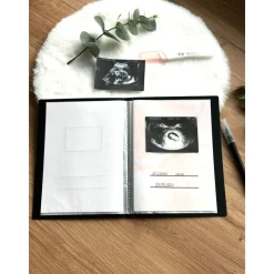 Personalisiertes Ultraschallbilder Album – Einsteckalbum zur sicheren Aufbewahrung und Geschenkidee