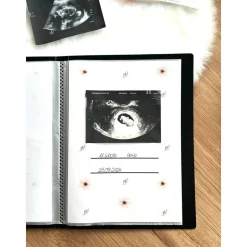Personalisiertes Ultraschallbilder Album – Stabiles Einsteckalbum zur Aufbewahrung & Geschenkidee