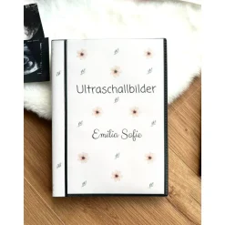 Personalisiertes Ultraschallbilder Album – Stabiles Einsteckalbum zur Aufbewahrung & Geschenkidee