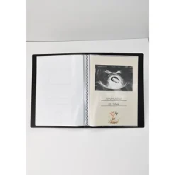 Ultraschallalbum personalisiert,  zur Aufbewahrung von Ultraschallfotos, Ultraschallbilder Mappe, Geschenk zur Geburt