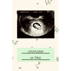 Ultraschallbilder Mappe Album für Ultraschallbilder personalisierbares Einsteckalbum stabile Aufbewahrung