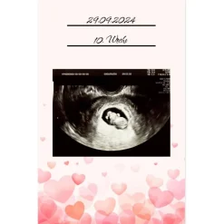 Ultraschallbilder Mappe Album für Ultraschallbilder personalisierbares Einsteckalbum stabile Aufbewahrung