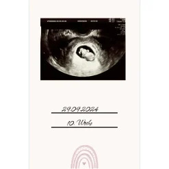Ultraschallbilder Mappe Album für Ultraschallbilder personalisierbares Einsteckalbum stabile Aufbewahrung