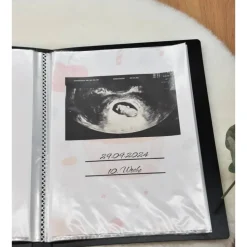 Ultraschallbilder Mappe Muffin, Ultraschallalbum,Ultraschall Album, personalisierte Ultraschallbilder Aufbewahrung